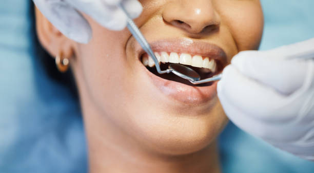 Best Emergency Treatment for Toothache in Security Widefield, CO
